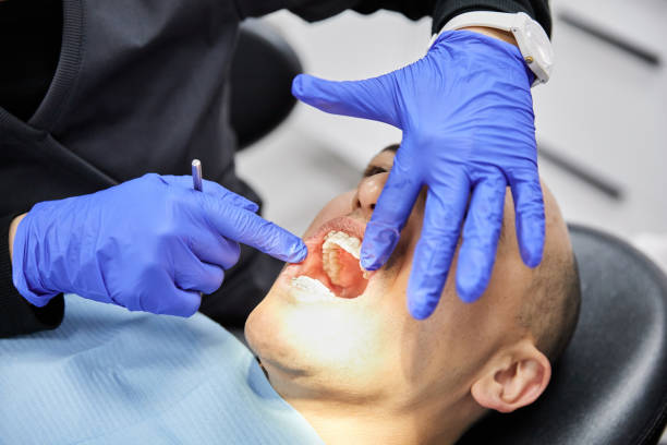 Best Dental Abscess Treatment in Dulles Town Center, VA